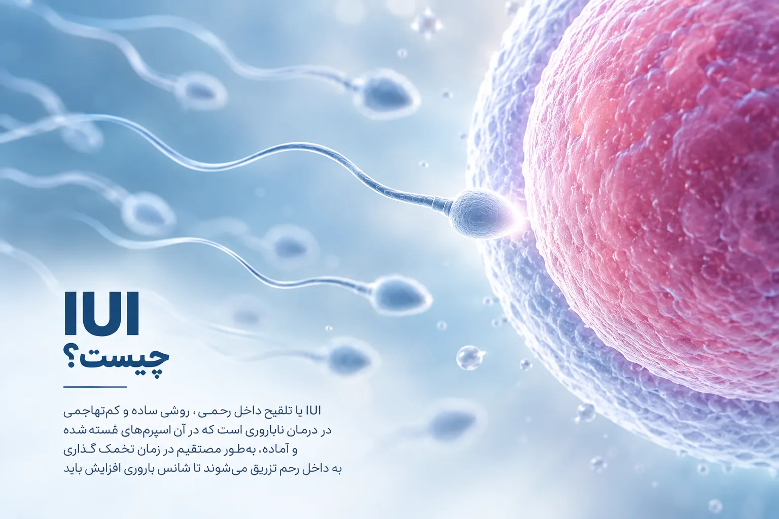 IUI چیست و مراحل لقاح داخل رحمی